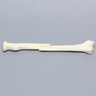 Radius with Short Oblique Fracture, 5.5mm Canal, Solid Foam