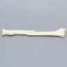 Radius with Short Oblique Fracture, 6.4mm Canal, Solid Foam