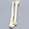Ulna and Radius, 5.5mm Canal, Solid Foam
