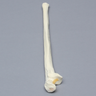 Ulna with Olecranon Fracture, Foam Cortical