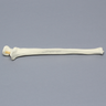 Ulna with Olecranon Fracture, Foam Cortical