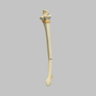 Ulna and Radius with Oblique and Transverse Fractures, Solid Foam