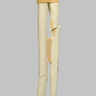 Ulna and Radius with Oblique and Transverse Fractures, Solid Foam