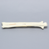 Ulna and Radius with Four-Part and Oblique Fractures, Solid Foam