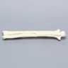 Ulna and Radius with Four-Part and Oblique Fractures, Solid Foam