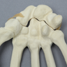 Hand with Moveable Carpal Section, Solid Foam