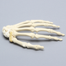 Hand with Scaphoid Fracture and Articulated Metacarpal, Solid Foam