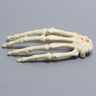 Hand with Scaphoid Fracture and Ligament, Solid Foam