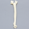 Radius, Three-Part Intra-Articular Fracture, Solid Foam