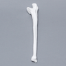 Ulna, 5mm Canal, Plastic Cortical