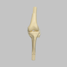 Converge™ Medium Left Knee with 7­­ Degree Varus Tibia