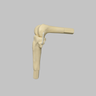 Converge™ Medium Left Knee with 7­­ Degree Varus Tibia