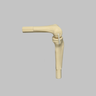 Converge™ Medium Left Knee with 7­­ Degree Varus Tibia