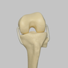 Converge™ Medium Left Knee with 7­­ Degree Varus Tibia