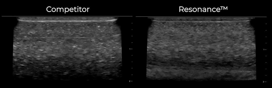 video comparison of needle tracking between competing material and Resonance™