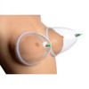Size Matters Breast Cupping System Size Matters Breast Cupping System